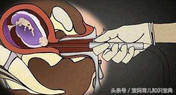 人工流产时胎儿是怎样打掉的看完这几种方式不禁让人流泪
