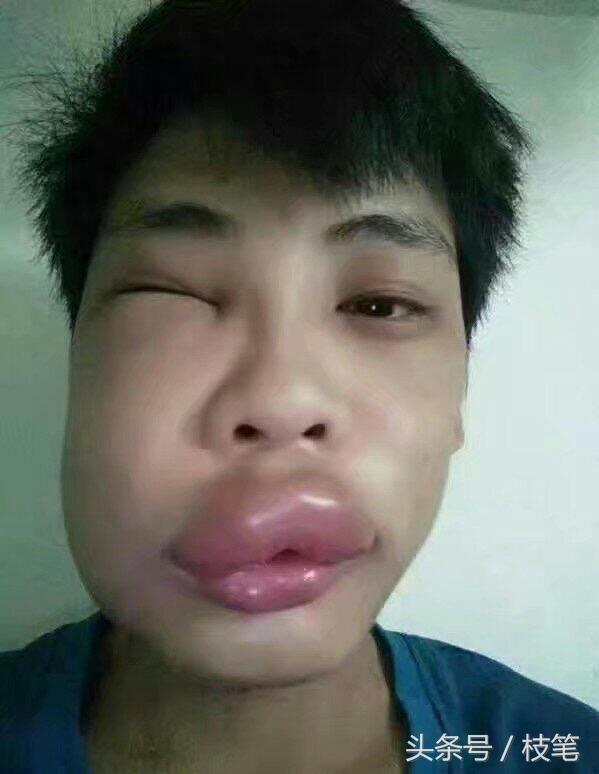 兄弟你肿么了,水嫩嫩的嘴唇好有魅力!