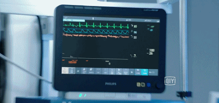 白百何做第一场手术时,患者突然发生了室颤(临终前的一种致命性心律