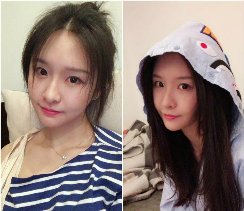 斗鱼阿冷不开播就用美容仪瘦脸?看来很在乎自己的脸庞啊