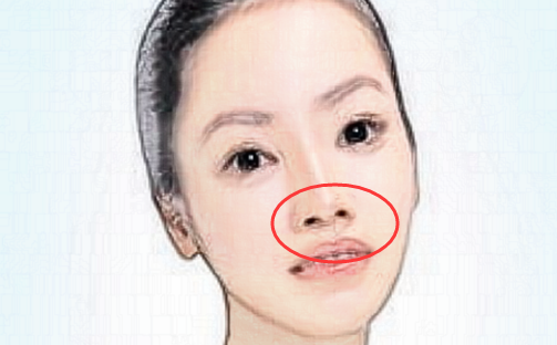 人中歪斜有疤痕人中在面相中为生殖器官的外窍,主要看一个人的子女