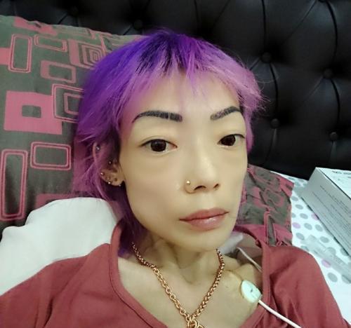 22岁嫁入豪门, 因全身瘫痪遭丈夫抛弃, 如今成骷髅人让人心疼