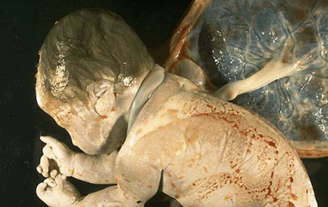 为省钱孕妇一直未产检,8个月偷偷产检后脸都吓白了