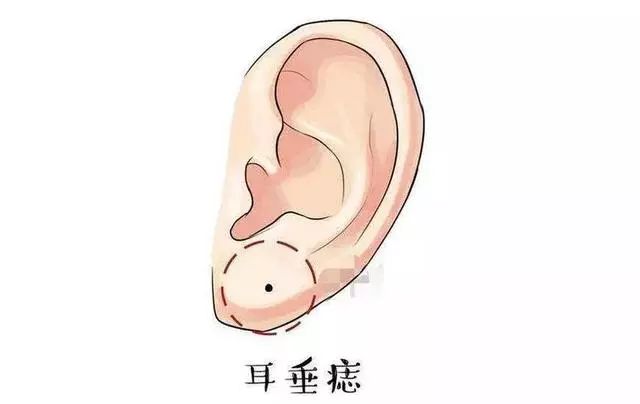 生有这样的耳朵,这辈子富贵团圆,福气满满能赚大钱|耳相|富贵|福气