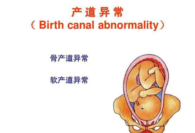 2,阴道,软产道,盆腔,宫颈出现特殊病变或畸形孕妇产前进行骨盆测量