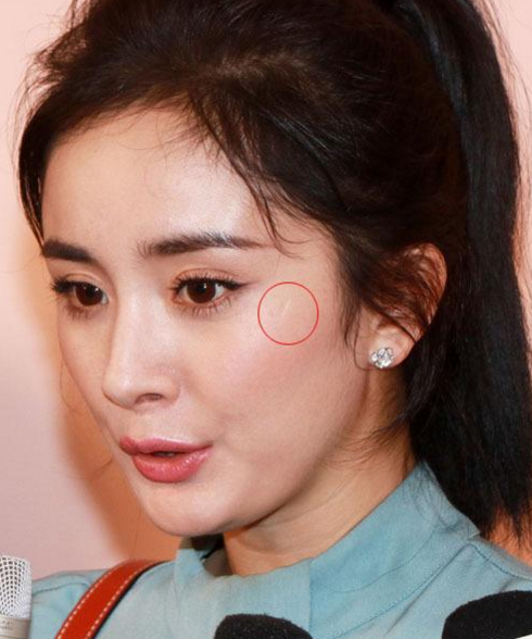 明星脸上的疤如何来?千玺打架,胡歌车祸,杨幂爬树,就服鹿晗