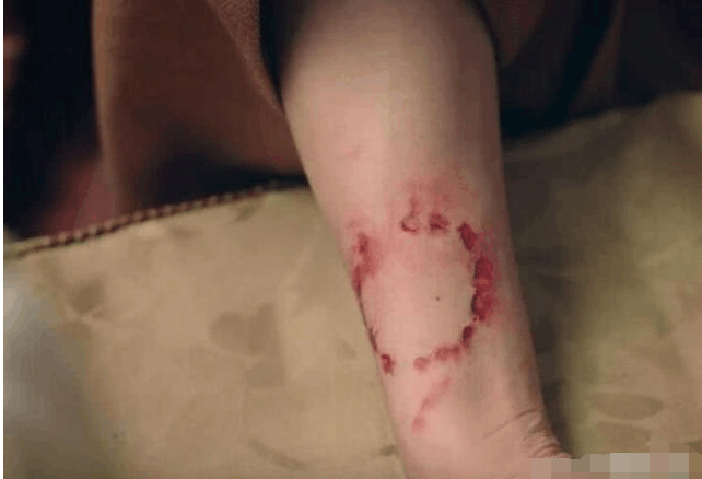 《三国机密》演员真敬业, 万茜把马天宇咬出了齿印