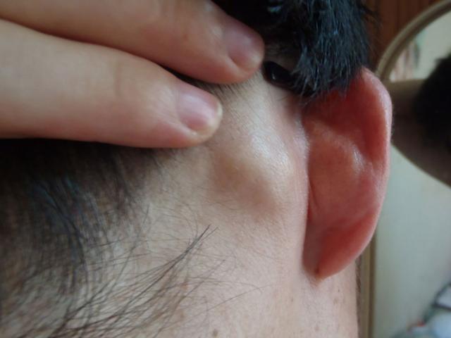 耳朵后面骨头图片