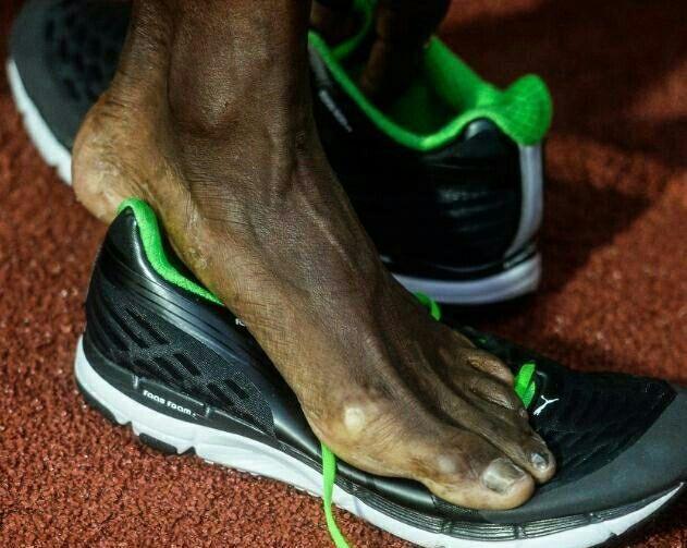 看看他的脚就知道了,难以置信|牙买加|博尔特|田径_新浪网