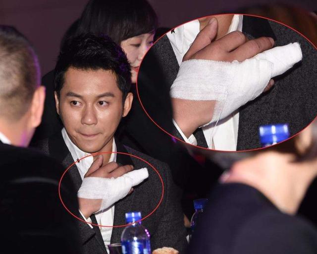 盘点因综艺节目受伤的三位明星,李晨只是缝针,他却因此丢了性命