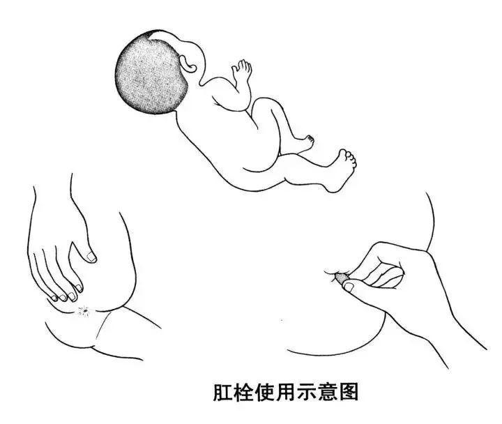 用肥皂和水彻底清洗双手;●如果栓剂是软的,在除去包装之前,先将它