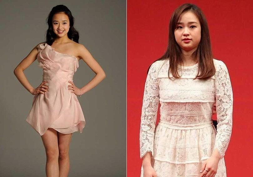 体坛明星一胖毁所有: 球王早已胖成球, 体操女皇1米54已经180斤