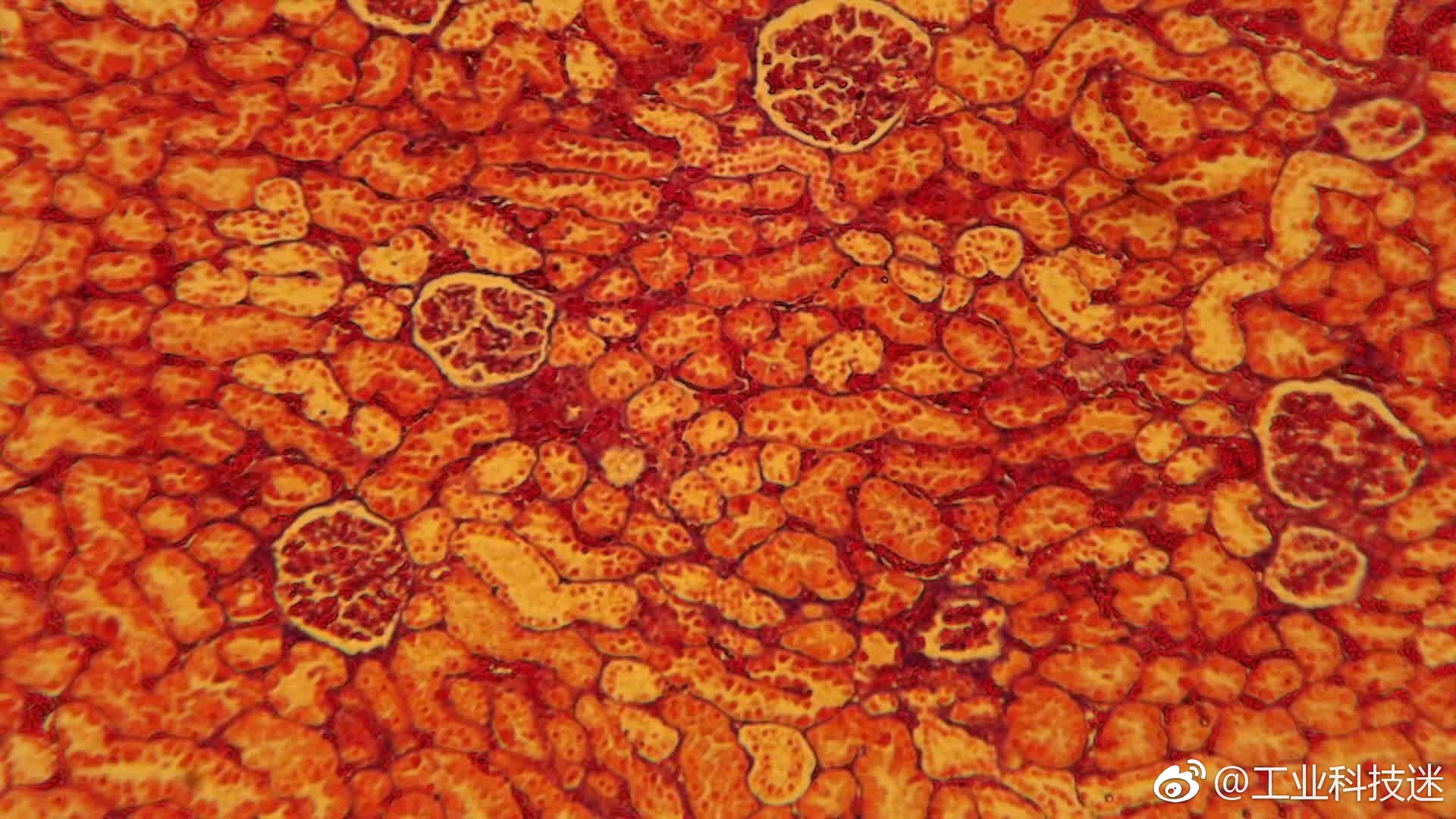 显微镜下的世界:肾切片