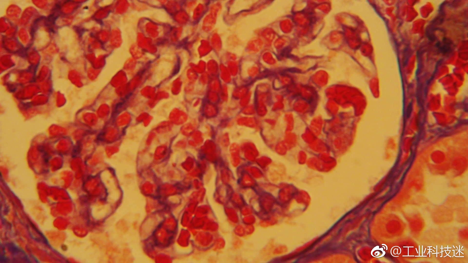 显微镜下的世界肾切片