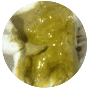 婴幼儿一天几次大便才正常?正常与异常的大便又是怎样的?