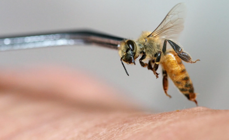 活蜂蜇针灸触发致命过敏反应|过敏反应|蜜蜂|针灸_新浪新闻