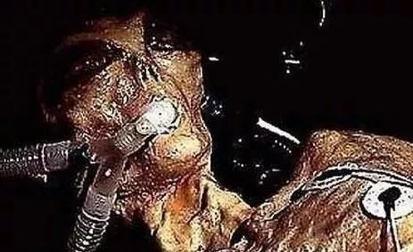 绝密档案:美国终于公布外星人尸体和坠毁的飞