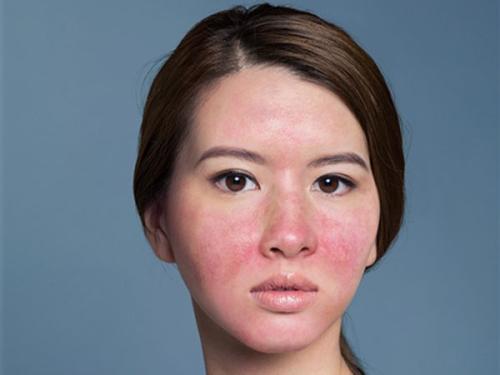 女人一定要看,别再粗心大意了|螨虫|毛孔|感染率_新浪新闻