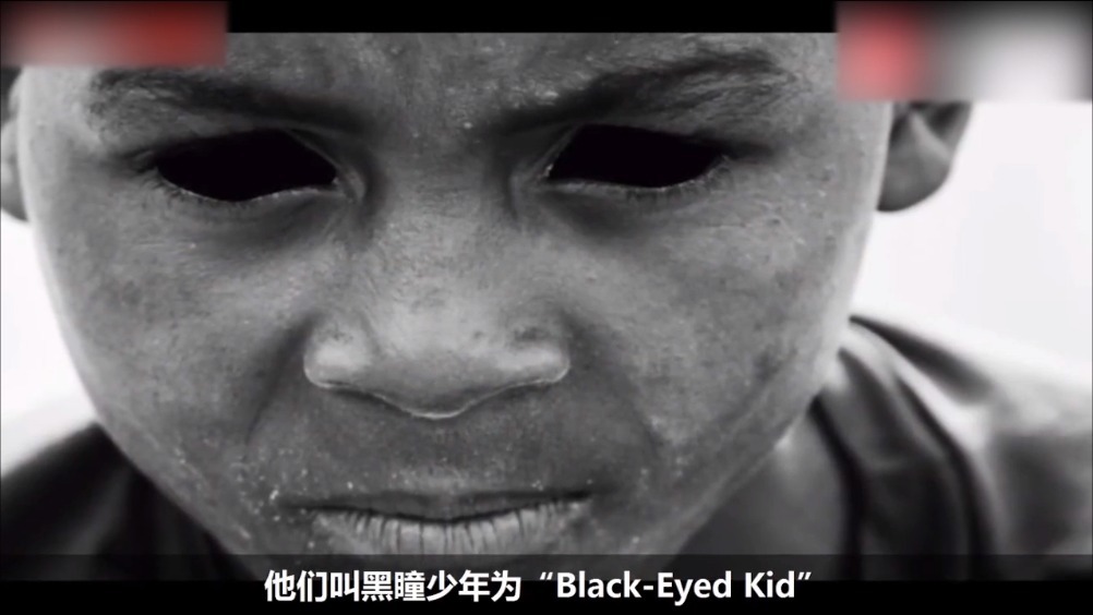 电影剧情黑瞳少年的传说瞳孔全黑被恶魔缠上的人你听过吗67