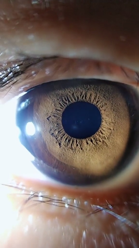 瞳孔放大和月球表面很像 谜之微笑 微博搞笑排行榜