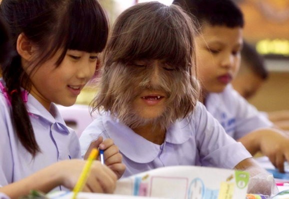 因为返祖现象,她还打破吉尼斯记录,一举称为"世界上毛发最长的女孩"