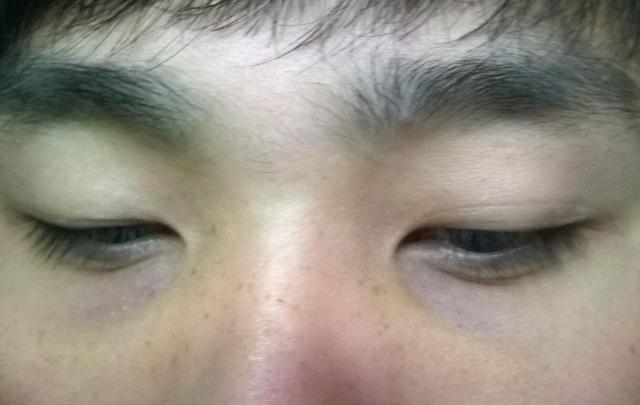 胃不好脸上马上出现这3个症状一招就让你调理好