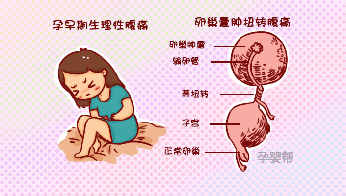 1,孕早期生理性腹痛诊断:正常症状:孕早期生理性腹痛比较常见,特别在