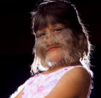 泰国17岁女"狼人"褪去毛发后,和男友结婚了,如今美成这样