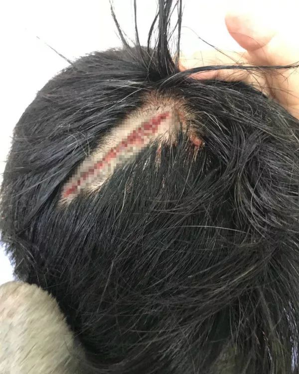 常州疯狂女乘客砍伤15路公交驾驶员司机头部血流不止