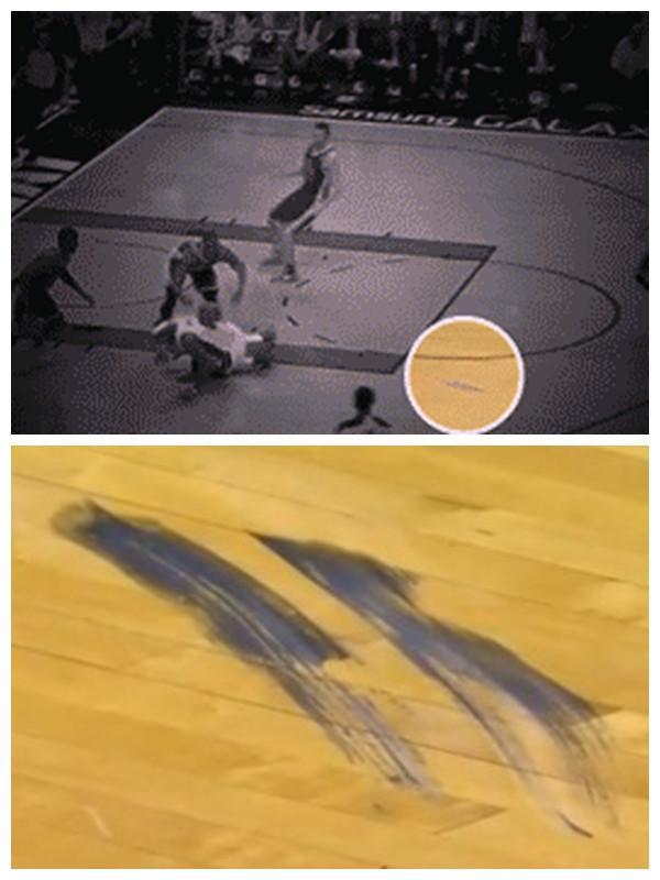 詹姆斯的身体有多逆天?崴脚踩一踩就好,生涯只动过一次手术