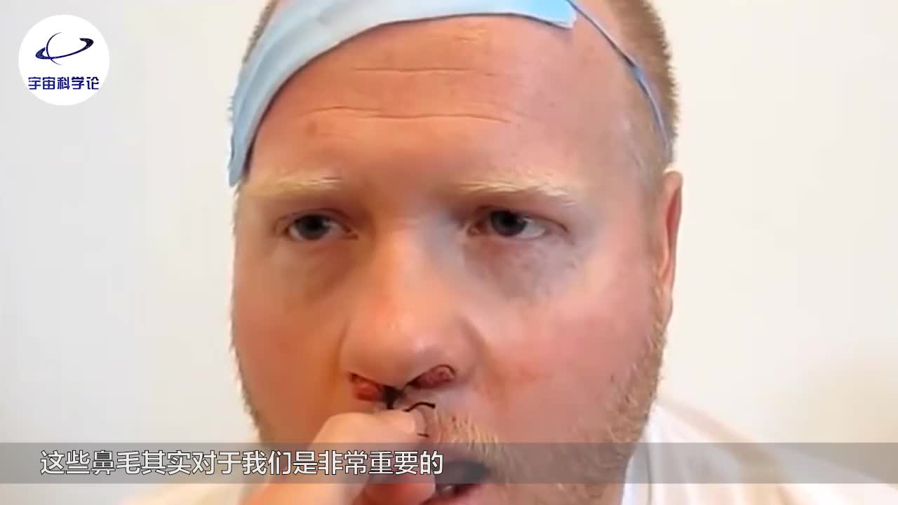 窜出来的鼻毛是拔掉好还是剪掉好拔掉会有什么后果