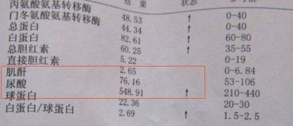 尿酸超标痛风突然找上门牢记喝2水吃3蔬让痛风安分下来