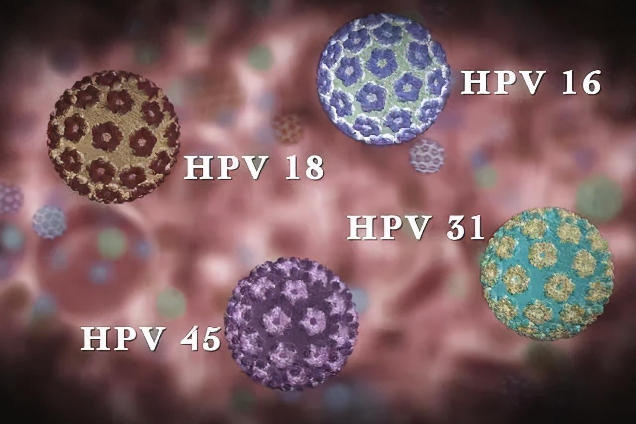 HPV阳性=宫颈癌?女性一定要知道这些知识|宫颈癌|女性|阳性_新浪新闻