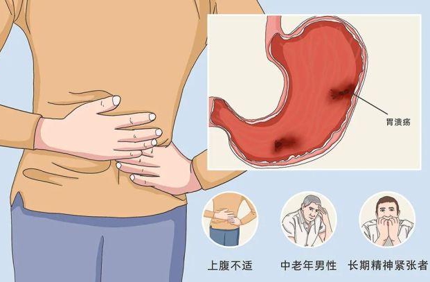 长沙东大肛肠医院为什么胃溃疡老是复发呢