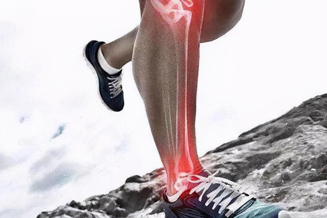 肌肉拉伤症状与感觉 如何应对运动损伤