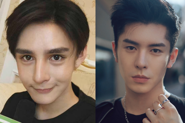整容脸变大帅哥,"猪鼻子"变美女,有些明星二次整容变得更好看