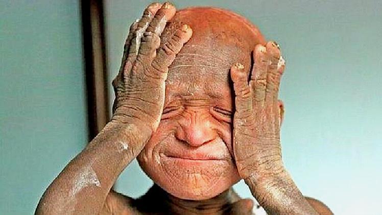 8元,印度6岁男孩为患病外公推担架车