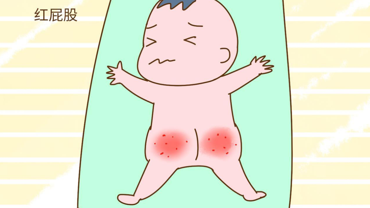 宝宝红屁屁,误信偏方,宝宝住院,差点还需要植皮