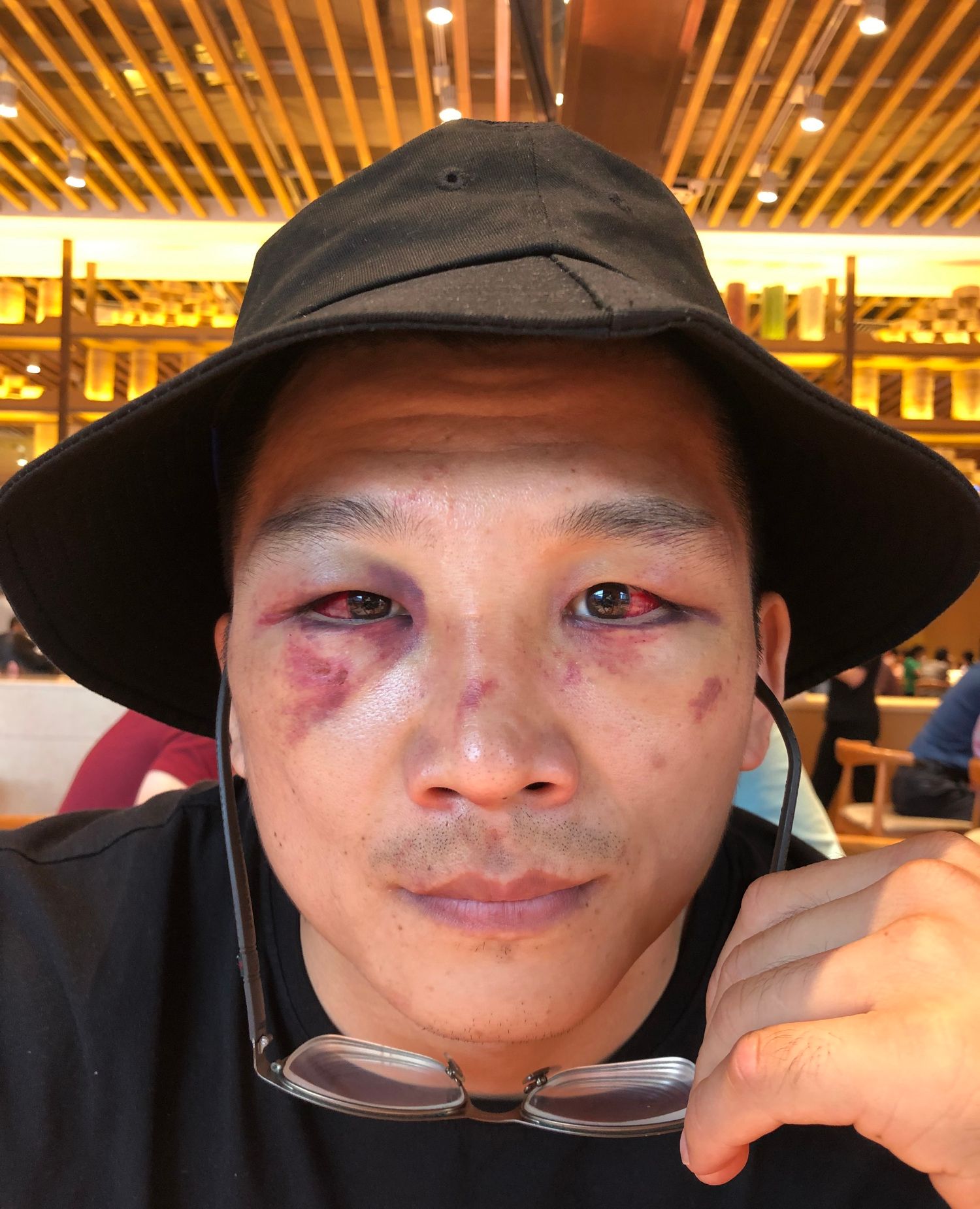 昆仑决最能打的拳王受伤严重,在京遭世界拳王挑战虽打赢却伤势重