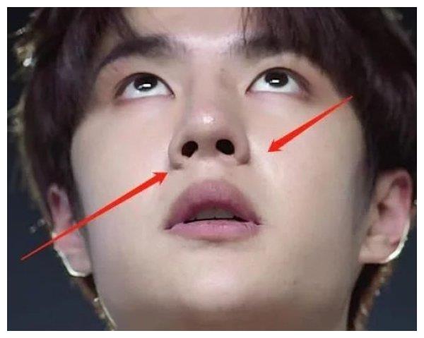 看了杨幂杨紫金晨的旧照终于知道为啥王源要去缩鼻翼了