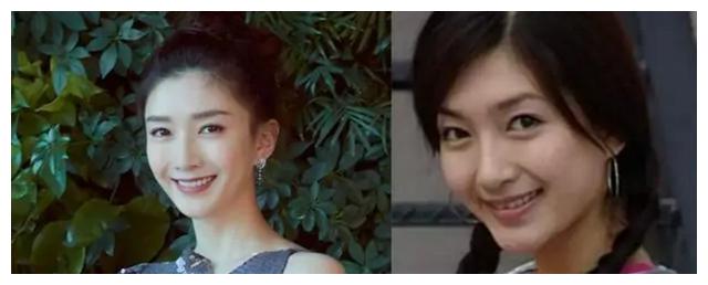 江疏影整容前旧照曝光单眼皮宽下巴皮肤蜡黄和如今判若两人