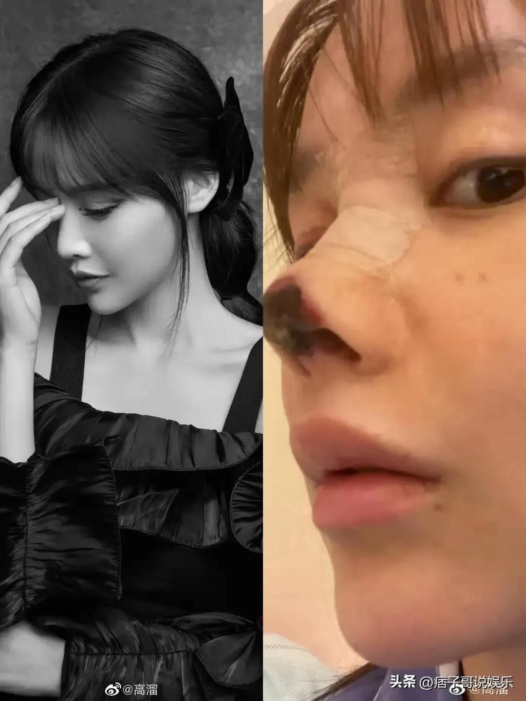 她是赵本山最漂亮的女徒弟“香秀”,因为整容失败哭的梨花带雨|乡村爱情|整容|赵本山_新浪新闻
