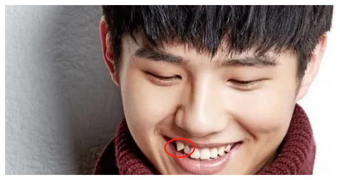 明星做烤瓷牙都翻车李佳琦很喜感像松鼠热巴曾因它脸垮显老