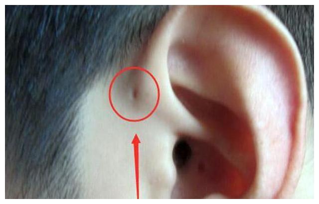 就是这个小孔,老人称为"仓眼","耳仓",又叫"福气孔",说是用来装福气