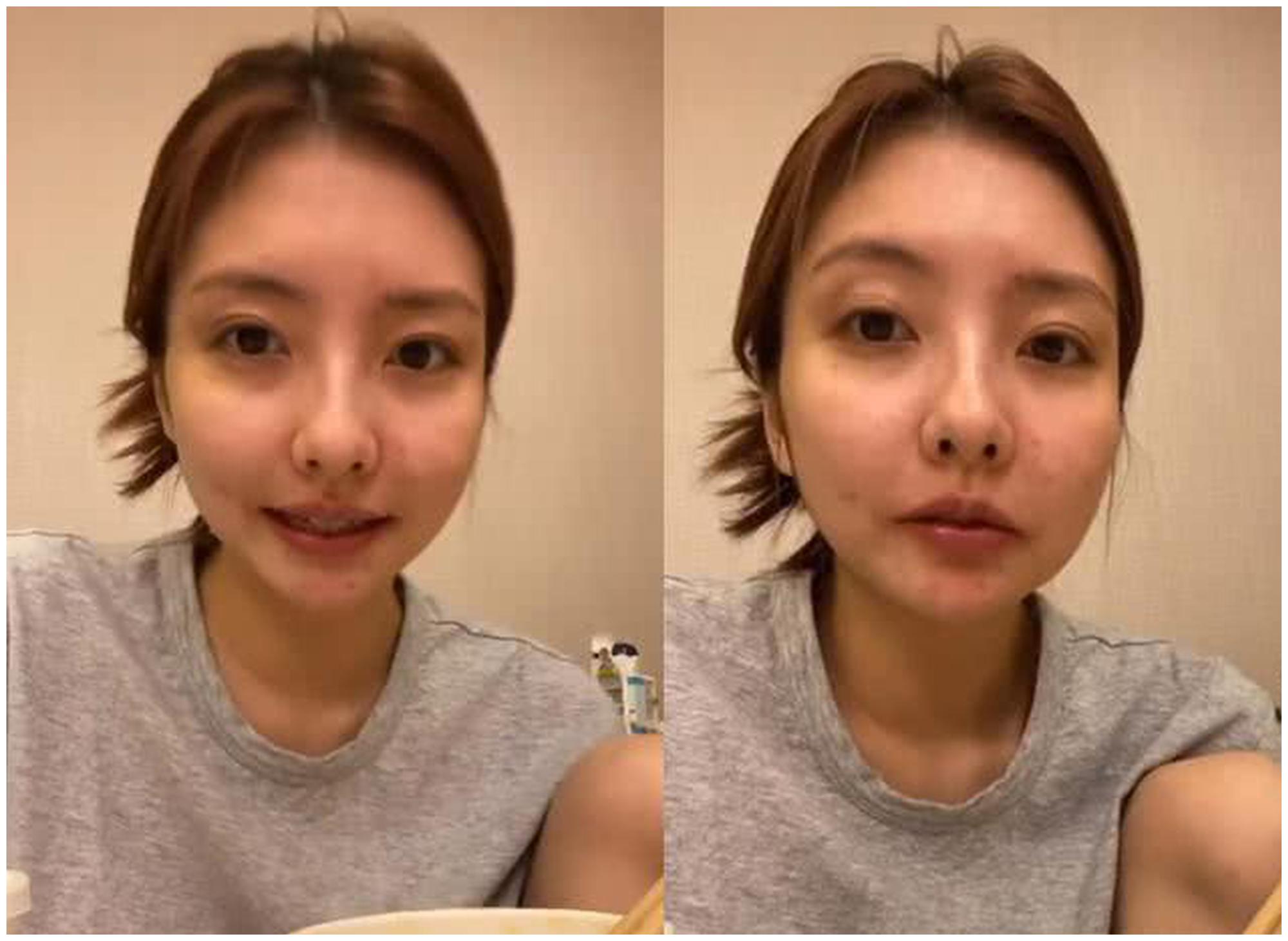 王思聪前女友豆得儿曝近照 面部肿胀状态差