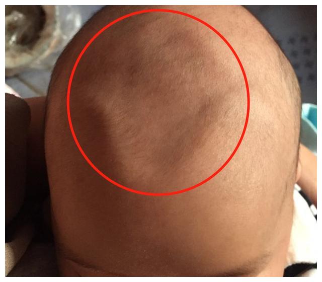 新手爸妈小课堂:新生儿这四个部位很容易受伤,照顾宝宝时要避开