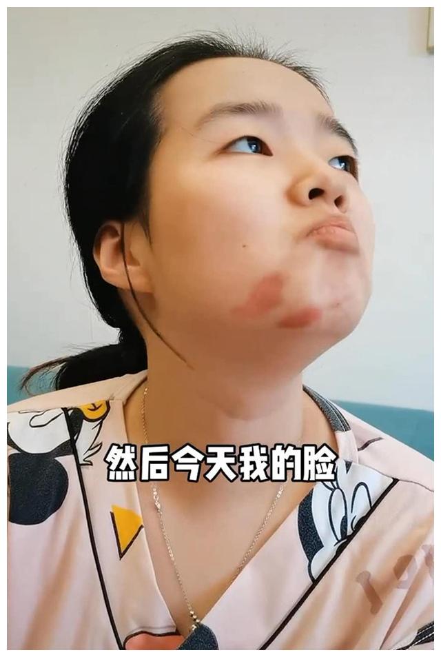 宝宝给妈妈"种草莓",引爸爸误会,妈妈视频为证,爸爸当场闭嘴