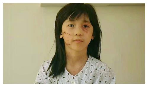 素媛原型8岁女童被人施暴到靠尿袋生活凶手却在今年出狱