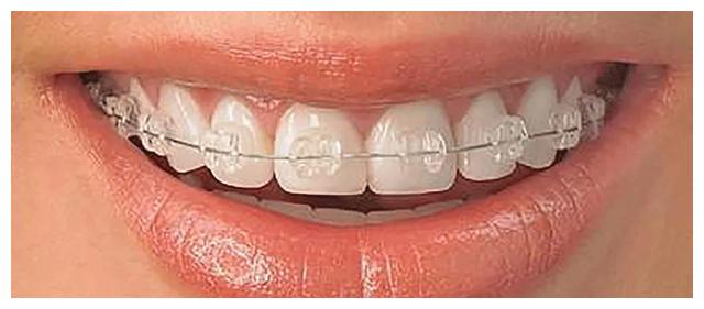 王子文偷偷"变了脸",却出现baby同款后遗症?