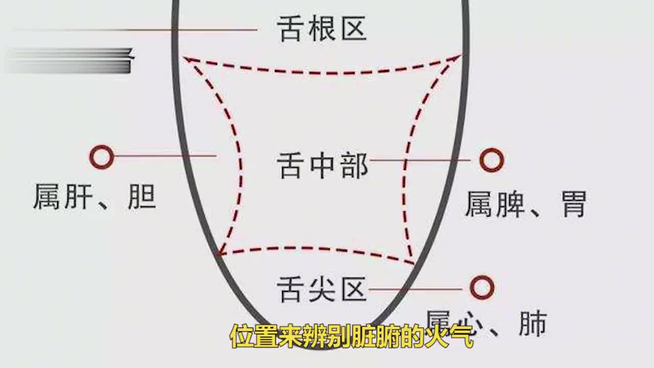 舌尖疼有心火,舌边疼有肝火,舌中疼有胃火,这几种方法轻松应对